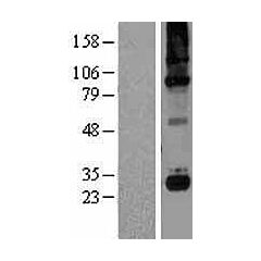 C1QC (NM_172369) Human Over-expression Lysate 
