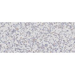 PD-L1 Analyte ControlDR 