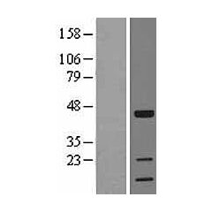TOB (TOB1) (NM_005749) Human Over-expression Lysate 