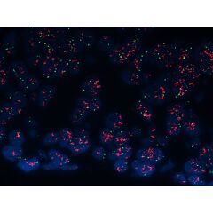 HER2 Analyte ControlDR 