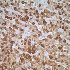 Polyclonal antibody against LH 