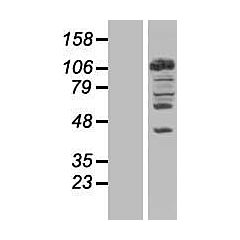 NEDD4 (Myc-DDK-tagged)-Human neural precursor cell expressed, developmentally down-regulated 4 (NEDD 4), transcript variant 1