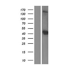OGG1 (Myc-DDK-tagged)-Human 8-oxoguanine DNA Glycosylase (OGG1), nuclear gene encoding Mitochondrial  protein, transcript variant 2b