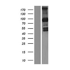 PCDHGB1 (Myc-DDK-tagged)-Human Protocadherin gamma subfamily B, 1 (PCDHGB1), transcript variant 2 