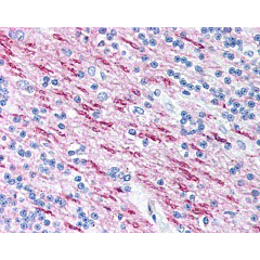 Mouse Anti-Human MBP (aa84 89) 