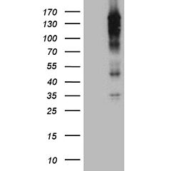 REV1 (Myc-DDK-tagged)-Human REV1 homolog (S. Cerevisiae) (REV1), transcript variant 1 