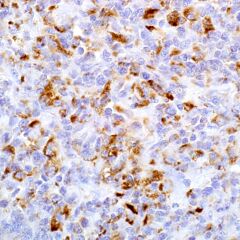 Adipophilin, polyclonal, rabbit, concentrate 