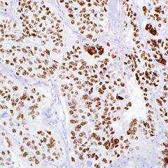 TFE3, MRQ-37, rabbit, concentrate 