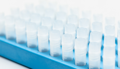 NTA-based Exosome Characterization