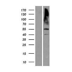 MATN3 (Myc-DDK-tagged)-Human matrilin 3 (MATN3) 