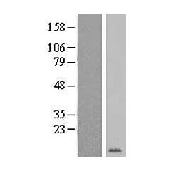 GYPE (Myc-DDK-tagged)-Human glycophorin E (MNS blood group) (GYPE), transcript variant 1 