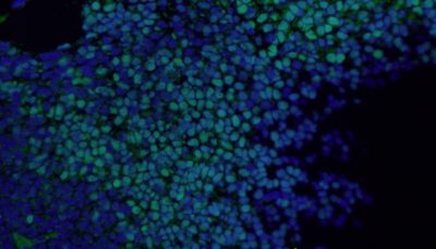 Markers of neuronal precursor cells (NPCs) / neural stem cells (NSCs)