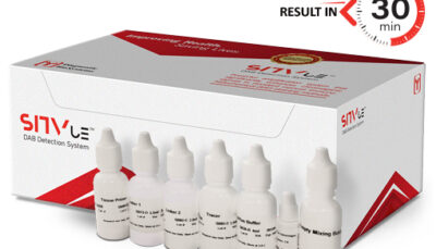 NEW: SITVue/DAB Detection System