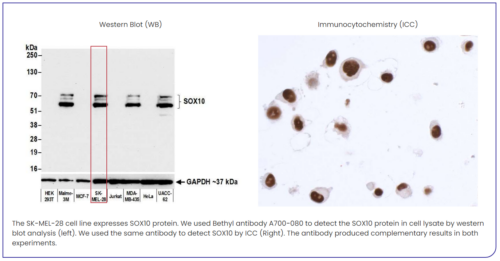 Bethyl Complementary Assays