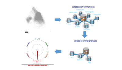 Flow cytometric diagnosis of acute leukemia with the Acute Leukemia Orientation Tube