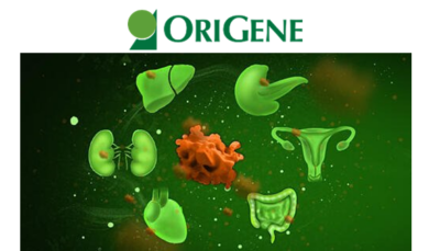 Role of HSD17B13 in NAFLD