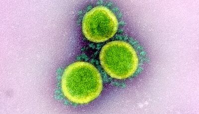 Two new options for expressing SARS-CoV-2 Proteins