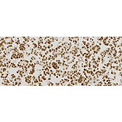 Breast Analyte ControlDR 