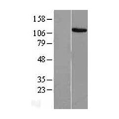 MECOM (Myc-DDK-tagged)-Human MDS1 and EVI1 complex locus (MECOM), transcript variant 2 