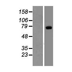 LRP10 (Myc-DDK-tagged)-Human low density Lipoprotein receptor-related Protein 10 (LRP10) 