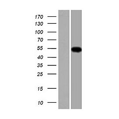 TMCO6 (Myc-DDK-tagged)-Human Transmembrane and coiled-coil domains 6 (TMCO6) 