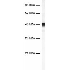 Glutamine synthetase 