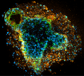 3D cell culture example