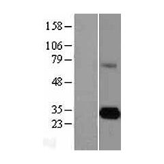 Elastase 3A (CELA3A) (NM_005747) Human Over-expression Lysate 