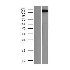 KIF4B (Myc-DDK-tagged)-Human Kinesin family member 4B (KIF4B) 