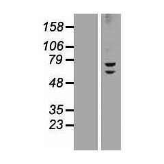 ZNF582 (Myc-DDK-tagged)-Human Zinc finger Protein 582 (ZNF582) 