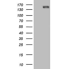 ITGAM (Myc-DDK-tagged)-Human integrin, alpha M (complement component 3 receptor 3 subunit) (ITGAM),  transcript variant 2