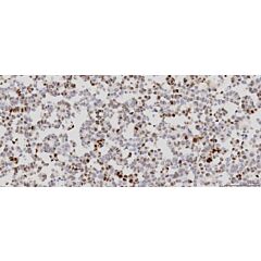 Progesterone Receptor Analyte ControlDR 