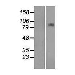 CPT1A (Myc-DDK-tagged)-Human carnitine Palmitoyltransferase 1A (liver) (CPT1A), nuclear gene encodin g mitochondrial protein, transcript variant 1