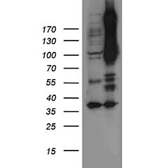 NOTCH4 (Myc-DDK-tagged)-Human notch 4 (NOTCH4) 